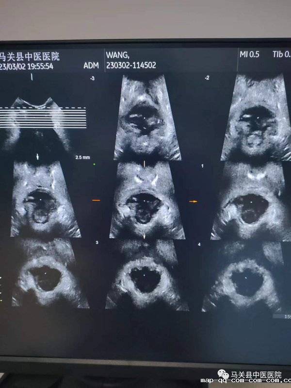 调整大小 2.png