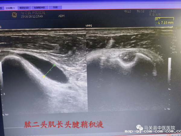 调整大小 2.png